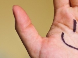 smile